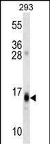 WB - RGS8 Antibody (N-term) AP16415a