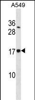 SSR4 Antibody (Center) (Cat. #AP16417c) western blot analysis in A549 cell line lysates (35ug/lane).This demonstrates the SSR4 antibody detected the SSR4 protein (arrow).