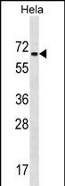 WB - ZNF35 Antibody (Center) AP16449c