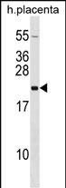WB - GH2 Antibody (N-term) AP16456a