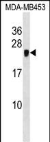 CRIP2 Antibody (C-term) (Cat. #AP16496b) western blot analysis in MDA-MB453 cell line lysates (35ug/lane).This demonstrates the CRIP2 antibody detected the CRIP2 protein (arrow).