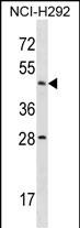 ACTL7B Antibody (N-term) (Cat. #AP16511a) western blot analysis in NCI-H292 cell line lysates (35ug/lane).This demonstrates the ACTL7B antibody detected the ACTL7B protein (arrow).