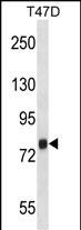 WB - ZC3H14 Antibody (Center) AP16512c