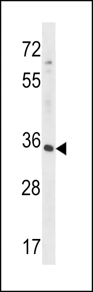 WB - RFNG Antibody (C-term) AP16514b