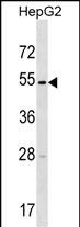 WB - TMPRSS11E Antibody (Center) AP16520c