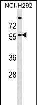 WB - ZDHHC13 Antibody (N-term) AP16525b