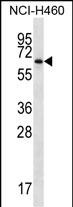 WB - ZBTB46 Antibody (Center) AP16533c