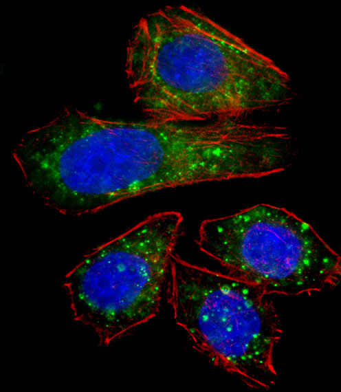 Fluorescent confocal image of U251 cell stained with ZNF81 Antibody (N-term)(Cat#AP16535a).U251 cells were fixed with 4% PFA (20 min), permeabilized with Triton X-100 (0.1%, 10 min), then incubated with ZNF81 primary antibody (1:25, 1 h at 37?). For secondary antibody, Alexa Fluor� 488 conjugated donkey anti-rabbit antibody (green) was used (1:400, 50 min at 37?).Cytoplasmic actin was counterstained with Alexa Fluor� 555 (red) conjugated Phalloidin (7units/ml, 1 h at 37?). Nuclei were counterstained with DAPI (blue) (10 �g/ml, 10 min).ZNF81 immunoreactivity is localized to Vesicles significantly and Cytoplasm weakly.