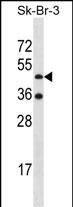 WB - ETNK2 Antibody (N-term) AP16541A