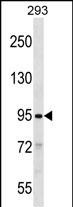 WB - SLITRK2 Antibody (C-term) AP16558b
