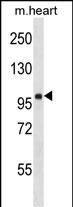 WB - FHOD1 Antibody (C-term) AP16586b