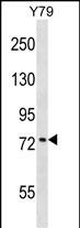 WB - KATNB1 Antibody (Center) AP16597c