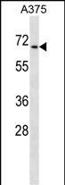 CDYL Antibody (N-term) (Cat. #AP16624a) western blot analysis in A375 cell line lysates (35ug/lane).This demonstrates the CDYL antibody detected the CDYL protein (arrow).