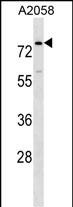 BCAS1 Antibody (N-term) (Cat. #AP16632a) western blot analysis in A2058 cell line lysates (35ug/lane).This demonstrates the BCAS1 antibody detected the BCAS1 protein (arrow).