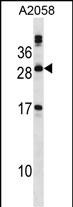 WB - PLA2G12A Antibody (Center) AP16639c
