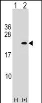 WB - PLA2G12A Antibody (Center) AP16639c