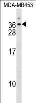 DLX6 Antibody (Center) (Cat. #AP16671c) western blot analysis in MDA-MB453 cell line lysates (35ug/lane).This demonstrates the DLX6 antibody detected the DLX6 protein (arrow).