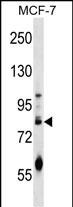 WB - ACRC Antibody (C-term) AP16679b