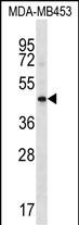 WB - HAPLN3 Antibody (Center) AP16704c