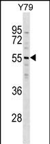 WB - ZNF620 Antibody (N-term) AP16707A
