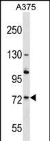 ACOX2 Antibody (N-term) (Cat. #AP16717a) western blot analysis in A375 cell line lysates (35ug/lane).This demonstrates the ACOX2 antibody detected the ACOX2 protein (arrow).