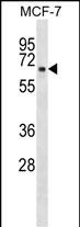 WB - TMEM5 Antibody (N-term) AP16719a