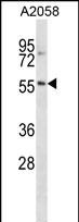 WB - NACC2 Antibody (C-term) AP16720b