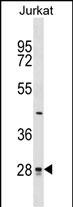 CTDSP1 Antibody (N-term) (Cat. #AP16726a) western blot analysis in Jurkat cell line lysates (35ug/lane).This demonstrates the CTDSP1 antibody detected the CTDSP1 protein (arrow).