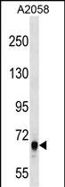 ARHGEF5 Antibody (C-term) (Cat. #AP16745b) western blot analysis in A2058 cell line lysates (35ug/lane).This demonstrates the ARHGEF5 antibody detected the ARHGEF5 protein (arrow).