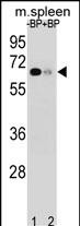 WB - ASB3 Antibody (N-term) AP16752a