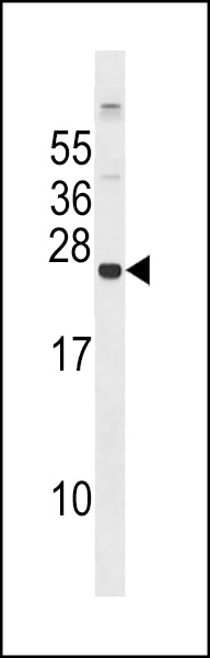 GPX8 Antibody (C-term) (Cat. #AP16753b) western blot analysis in 293 cell line lysates (35ug/lane).This demonstrates the GPX8 antibody detected the GPX8 protein (arrow).