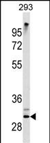 ZWINT Antibody (Cat. #AM2010b) western blot analysis in 293 cell line lysates (35?g/lane).This demonstrates the ZWINT antibody detected the ZWINT protein (arrow).