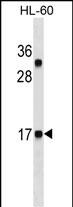 CALCA/CT Antibody (Cat. #AM2021a) western blot analysis in HL-60 cell line lysates (35?g/lane).This demonstrates the CALCA/CT antibody detected the CALCA/CT protein (arrow).