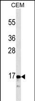 CALCA/CT Antibody (Cat. #AM2021b) western blot analysis in CEM cell line lysates (35?g/lane).This demonstrates the CALCA/CT antibody detected the CALCA/CT protein (arrow).