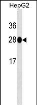 HNMT Antibody (Cat. #AM2023a) western blot analysis in HepG2 cell line lysates (35?g/lane).This demonstrates the HNMT antibody detected the HNMT protein (arrow).