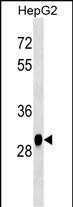 HNMT Antibody (Cat. #AM2023b) western blot analysis in HepG2 cell line lysates (35?g/lane).This demonstrates the HNMT antibody detected the HNMT protein (arrow).
