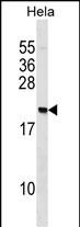WB - PAIP2 Antibody (N-term) AP16769a