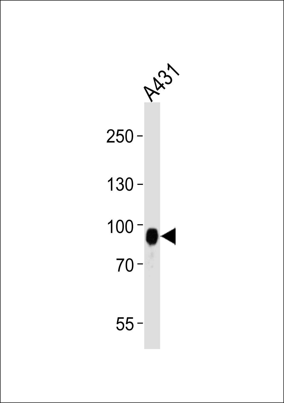 Western blot analysis of lysate from A431 cell line, using DSC3 Antibody (C-term)(Cat. #AP16771b). AP16771b was diluted at 1:1000 at each lane. A goat anti-rabbit IgG H&L(HRP) at 1:5000 dilution was used as the secondary antibody. Lysate at 35ug per lane. 