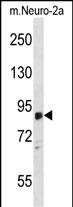 WB - ZDHHC8 Antibody (C-term) AP16774B