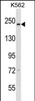 NCAPD3 Antibody (C-term) (Cat. #AP16786b) western blot analysis in K562 cell line lysates (35ug/lane).This demonstrates the NCAPD3 antibody detected the NCAPD3 protein (arrow).