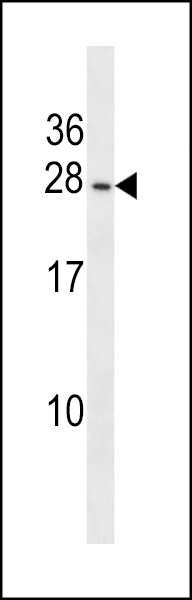 PIGP Antibody (N-term) (Cat. #AP16809a) western blot analysis in T47D cell line lysates (35ug/lane).This demonstrates the PIGP antibody detected the PIGP protein (arrow).