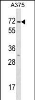 WB - KRT75 Antibody (N-term) AP16811A