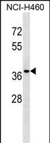 WB - CUTC Antibody (Center) AP16821c
