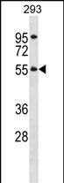 WB - TTC8 Antibody (N-term) AP16824a