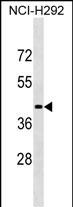 WB - LIPN Antibody (C-term) AP16829b