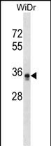 PIGL Antibody (N-term) (Cat. #AP16850a) western blot analysis in WiDr cell line lysates (35ug/lane).This demonstrates the PIGL antibody detected the PIGL protein (arrow).