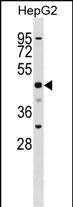 WB - SLC2A9 Antibody (N-term) AP16871a