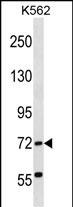 ABCF2 Antibody (N-term) (Cat. #AP16883a) western blot analysis in K562 cell line lysates (35ug/lane).This demonstrates the ABCF2 antibody detected the ABCF2 protein (arrow).
