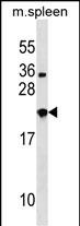 WB - NXPH3 Antibody (N-term) AP16892a