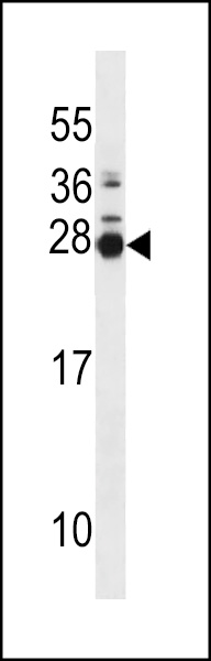 WB - MOL2B Antibody (N-term) AP16893a